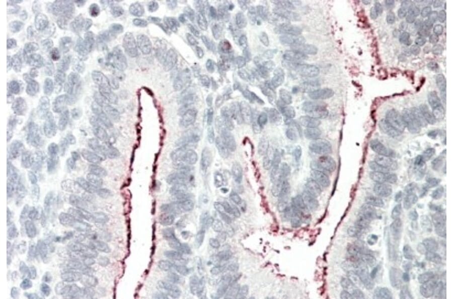 Immunohistochemistry - Anti-BCAR1 Antibody (A82532) - Antibodies.com