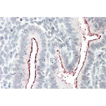 Immunohistochemistry - Anti-BCAR1 Antibody (A82532) - Antibodies.com