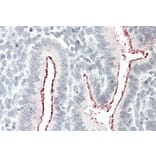 Immunohistochemistry - Anti-BCAR1 Antibody (A82532) - Antibodies.com