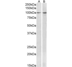 Western Blot - Anti-BCAR1 Antibody (A82532) - Antibodies.com
