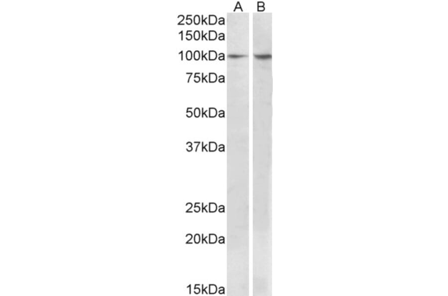 Western Blot - Anti-BCAR1 Antibody (A82532) - Antibodies.com