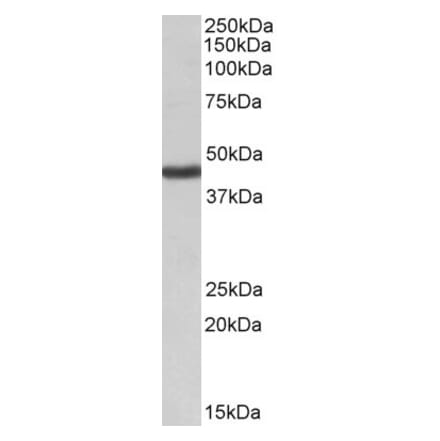 Western Blot - Anti-KCNJ1 Antibody (A82533) - Antibodies.com