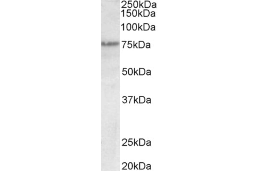 Western Blot - Anti-p63 Antibody (A82534) - Antibodies.com