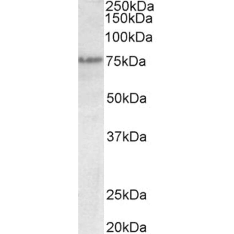 Western Blot - Anti-p63 Antibody (A82534) - Antibodies.com