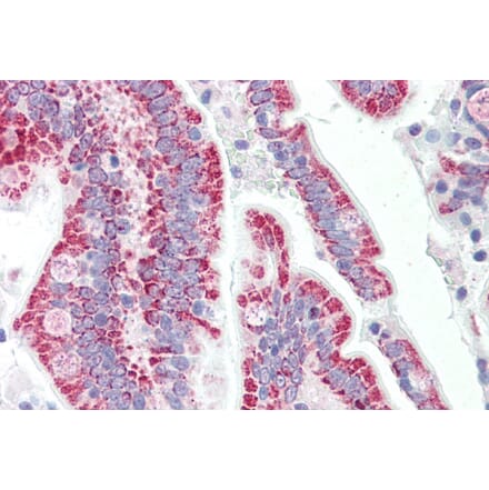 Immunohistochemistry - Anti-SON Antibody (A82535) - Antibodies.com