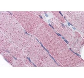 Immunohistochemistry - Anti-PACE4 Antibody (A82536) - Antibodies.com