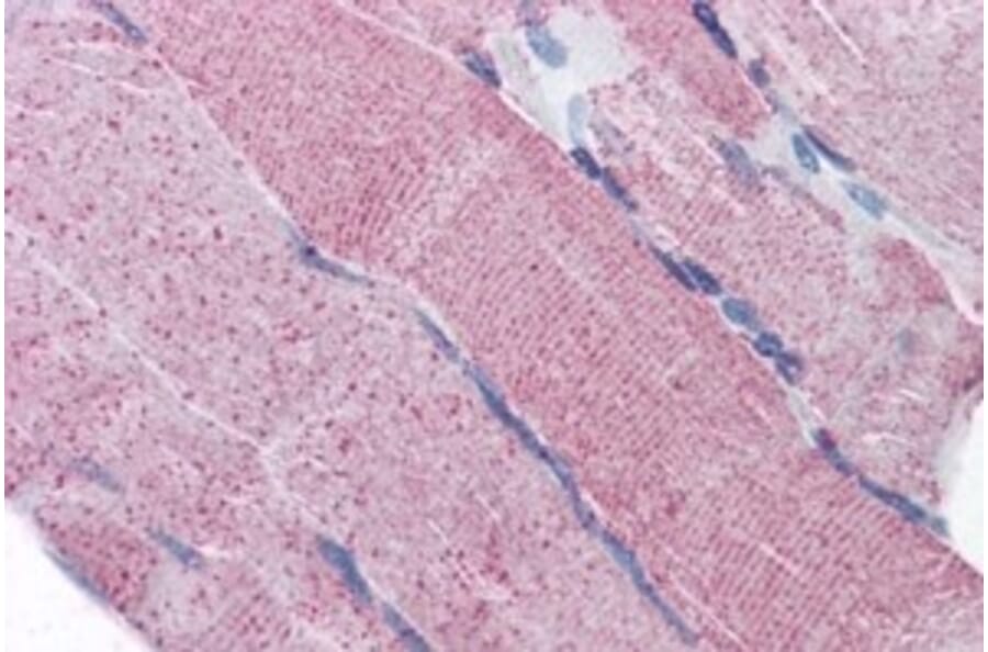 Immunohistochemistry - Anti-PACE4 Antibody (A82536) - Antibodies.com