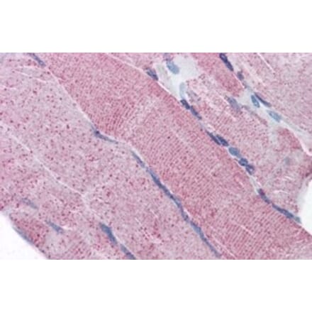 Immunohistochemistry - Anti-PACE4 Antibody (A82536) - Antibodies.com