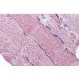 Immunohistochemistry - Anti-PACE4 Antibody (A82536) - Antibodies.com