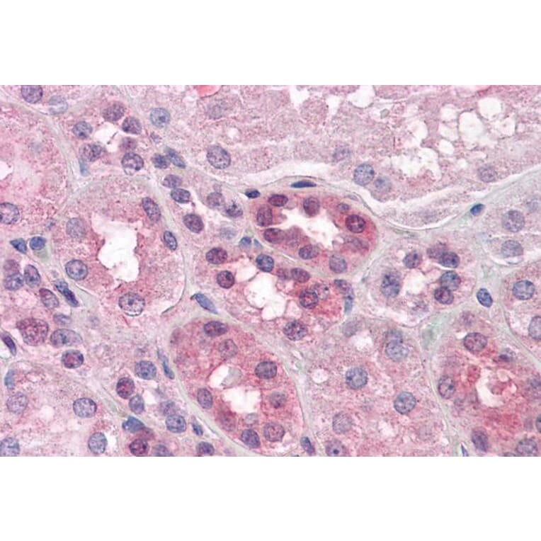 Immunohistochemistry - Anti-PACE4 Antibody (A82536) - Antibodies.com
