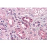 Immunohistochemistry - Anti-PACE4 Antibody (A82536) - Antibodies.com