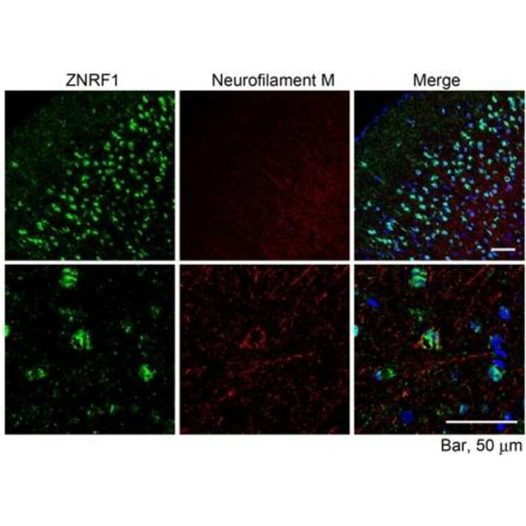 Immunohistochemistry - Anti-ZNRF1 Antibody (A82537) - Antibodies.com