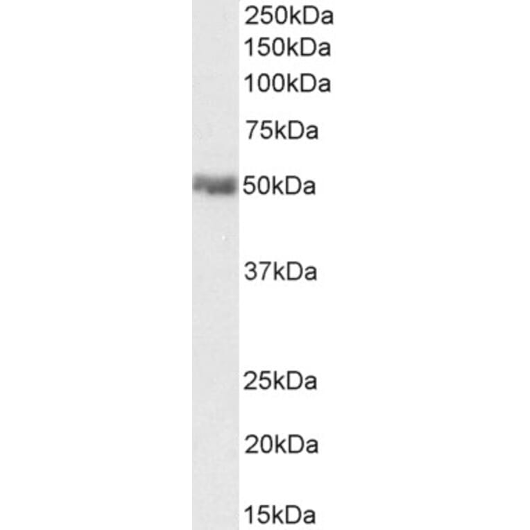 Western Blot - Anti-PD-L1 Antibody (A82538) - Antibodies.com