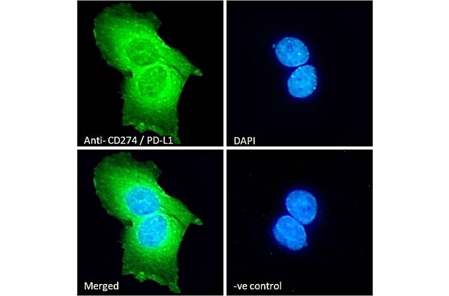 Immunofluorescence - Anti-PD-L1 Antibody (A82538) - Antibodies.com