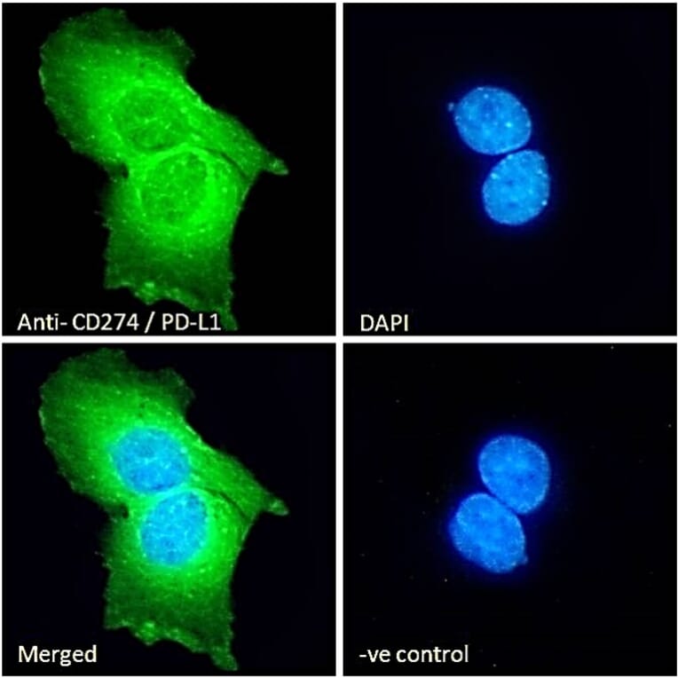 Immunofluorescence - Anti-PD-L1 Antibody (A82538) - Antibodies.com