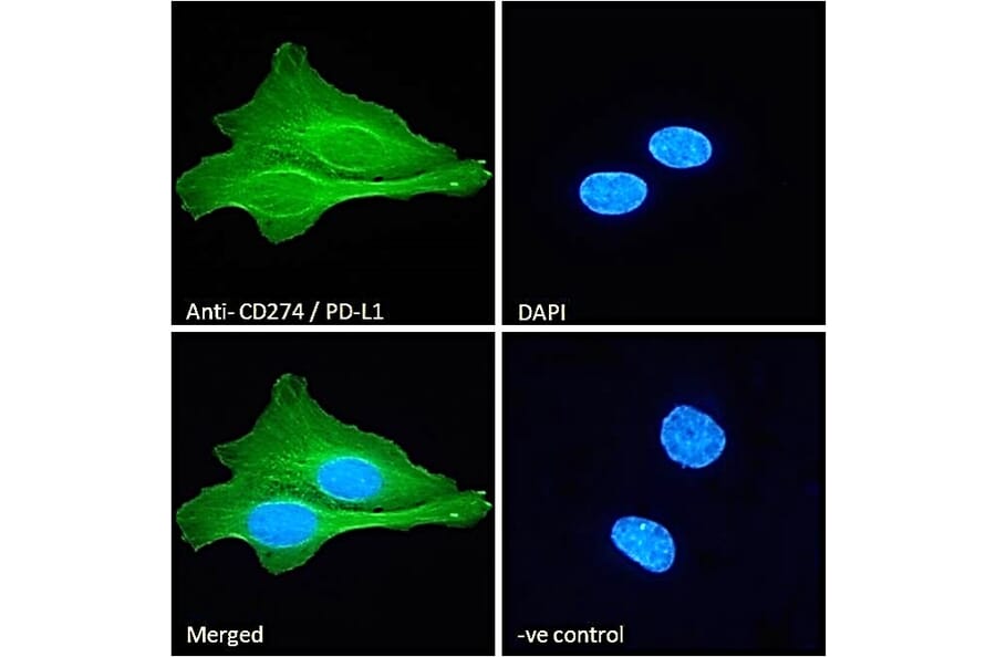 Immunofluorescence - Anti-PD-L1 Antibody (A82538) - Antibodies.com