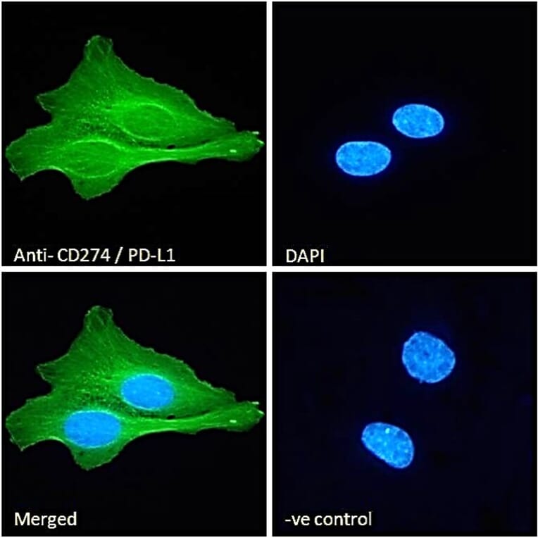 Immunofluorescence - Anti-PD-L1 Antibody (A82538) - Antibodies.com