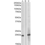 Western Blot - Anti-HOXA1 Antibody (A82540) - Antibodies.com