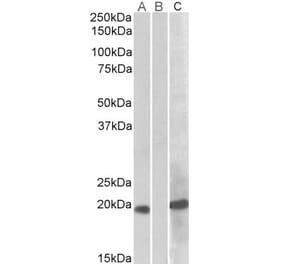 Western Blot - Anti-HOXA1 Antibody (A82540) - Antibodies.com