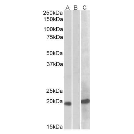 Western Blot - Anti-HOXA1 Antibody (A82540) - Antibodies.com