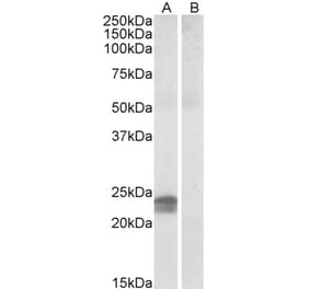 Western Blot - Anti-HMGA1a / HMGA1b Antibody (A82541) - Antibodies.com