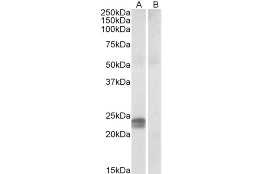 Western Blot - Anti-HMGA1a / HMGA1b Antibody (A82541) - Antibodies.com