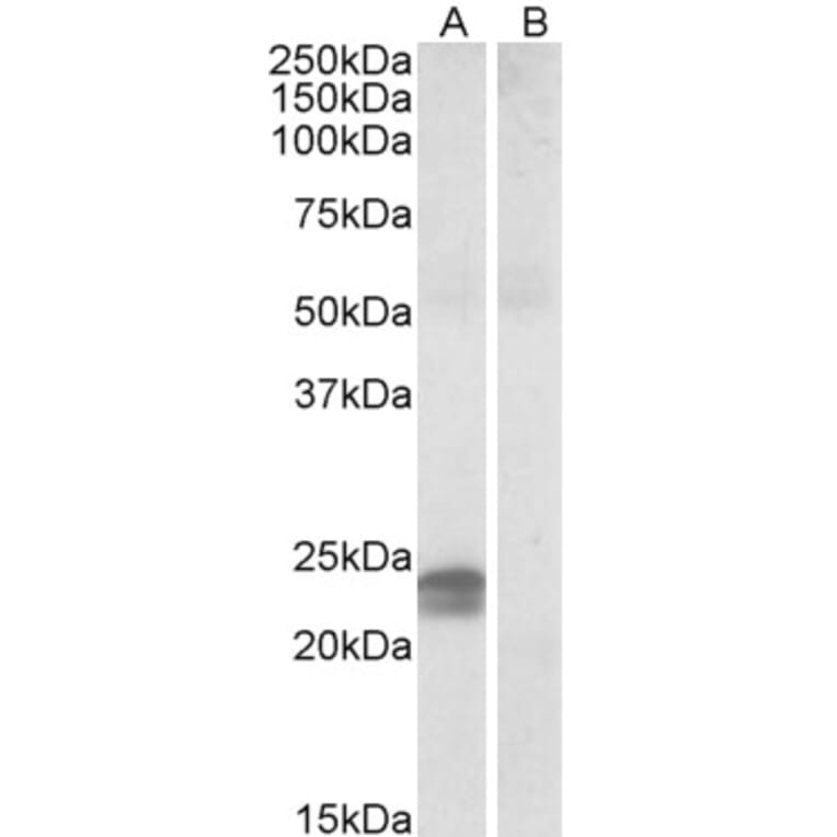 Western Blot - Anti-HMGA1a / HMGA1b Antibody (A82541) - Antibodies.com