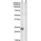 Western Blot - Anti-HMGA1a / HMGA1b Antibody (A82541) - Antibodies.com