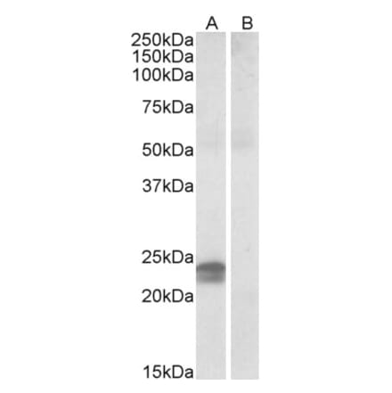 Western Blot - Anti-HMGA1 Antibody (A82541) - Antibodies.com