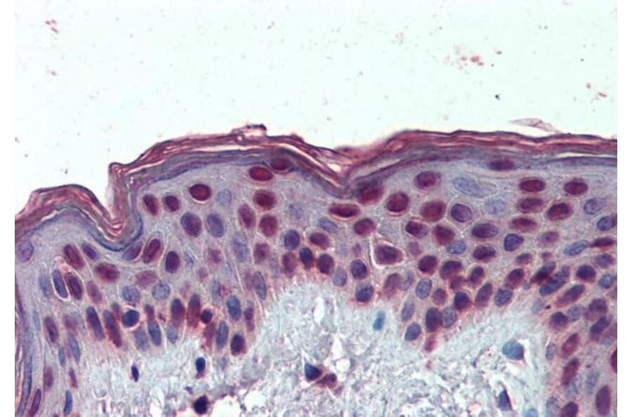 Immunohistochemistry - Anti-HMGA1a / HMGA1b Antibody (A82541) - Antibodies.com