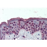 Immunohistochemistry - Anti-HMGA1a / HMGA1b Antibody (A82541) - Antibodies.com