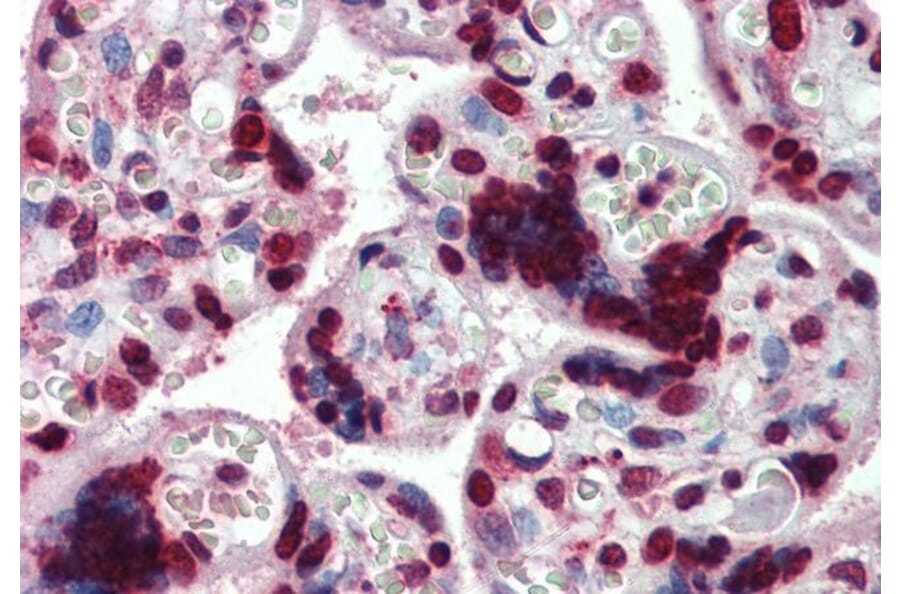 Immunohistochemistry - Anti-HMGA1a / HMGA1b Antibody (A82541) - Antibodies.com