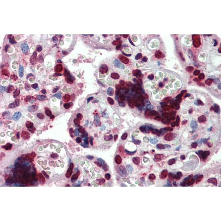 Immunohistochemistry - Anti-HMGA1a / HMGA1b Antibody (A82541) - Antibodies.com