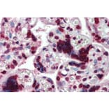 Immunohistochemistry - Anti-HMGA1a / HMGA1b Antibody (A82541) - Antibodies.com