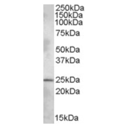 Western Blot - Anti-PHR1 Antibody (A82542) - Antibodies.com