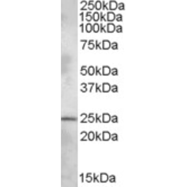 Western Blot - Anti-PHR1 Antibody (A82542) - Antibodies.com