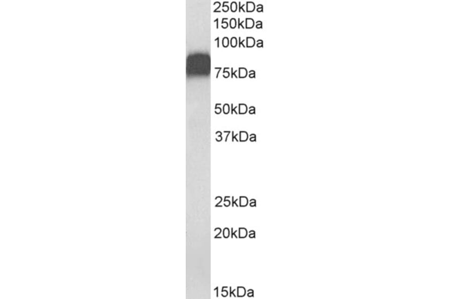 Western Blot - Anti-CD44 Antibody (A82545) - Antibodies.com