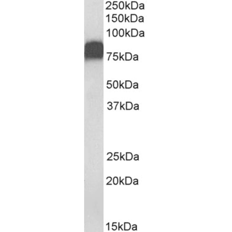 Western Blot - Anti-CD44 Antibody (A82545) - Antibodies.com