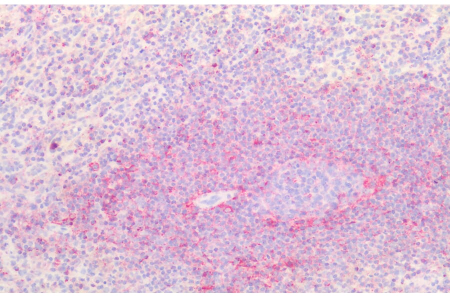 Immunohistochemistry - Anti-CD44 Antibody (A82545) - Antibodies.com