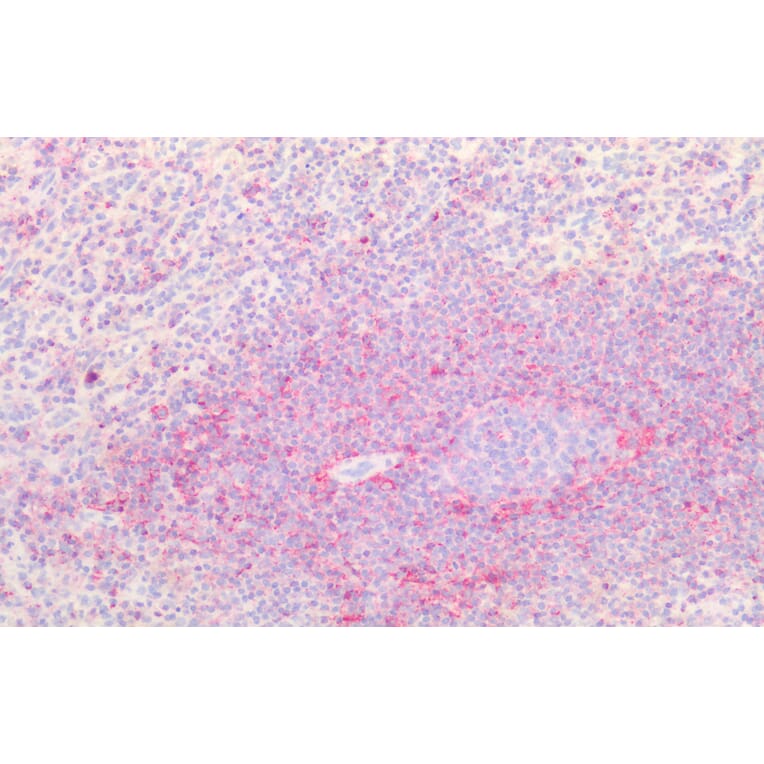 Immunohistochemistry - Anti-CD44 Antibody (A82545) - Antibodies.com