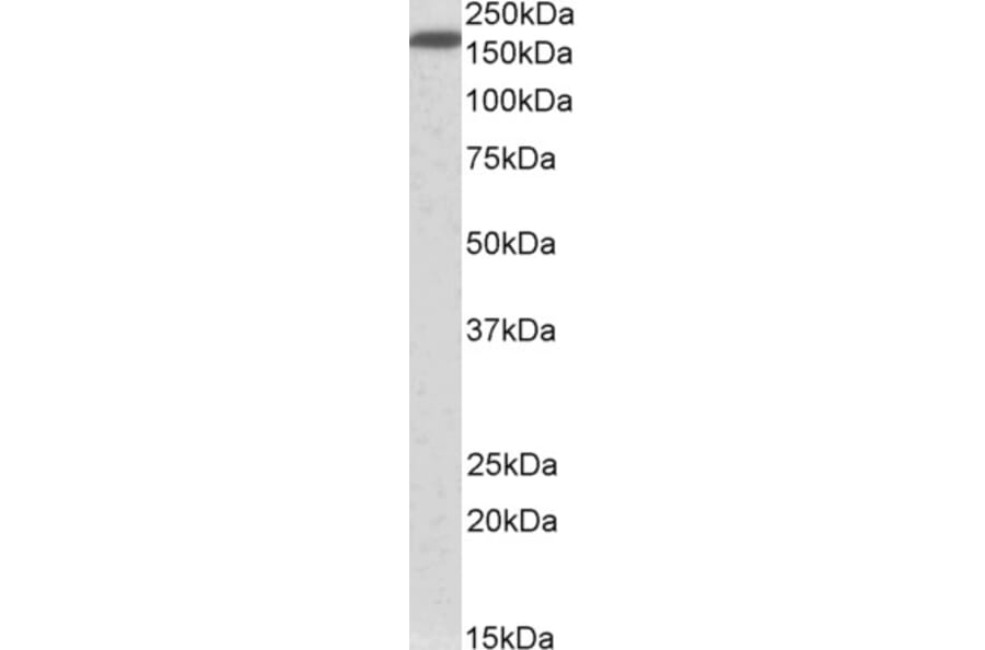 Western Blot - Anti-Neurofascin Antibody (A82546) - Antibodies.com