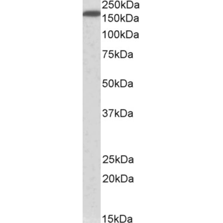 Western Blot - Anti-Neurofascin Antibody (A82546) - Antibodies.com