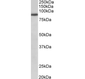 Western Blot - Anti-FGFR1 Antibody (A82547) - Antibodies.com
