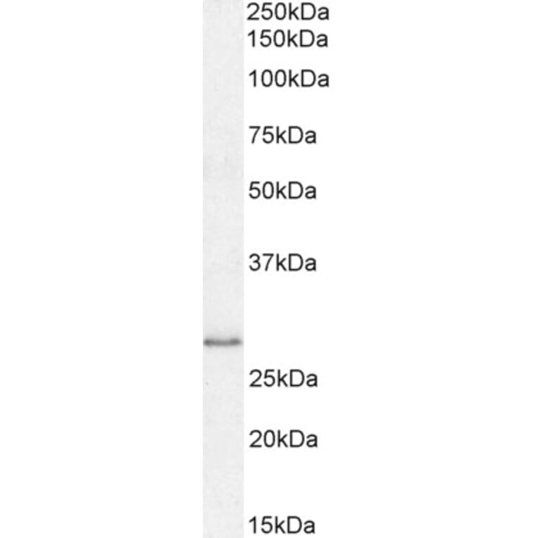 Western Blot - Anti-MyD88 Antibody (A82548) - Antibodies.com