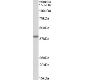 Western Blot - Anti-PDLIM2 Antibody (A82552) - Antibodies.com