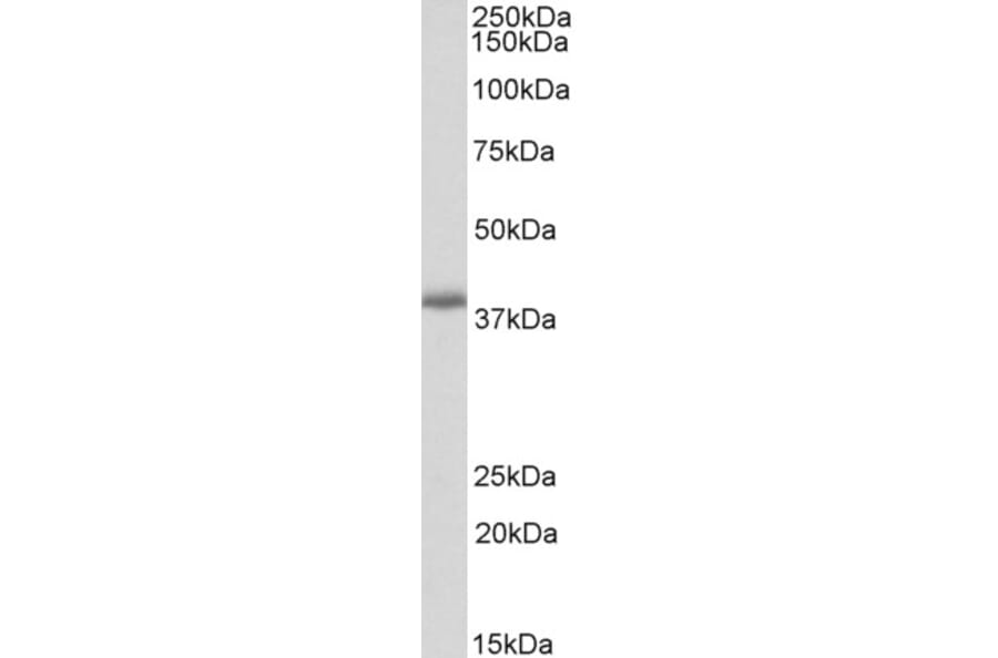Western Blot - Anti-PDLIM2 Antibody (A82552) - Antibodies.com