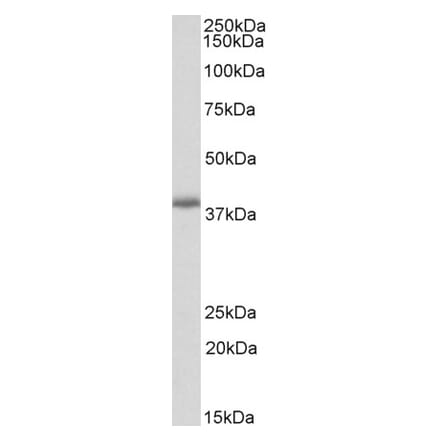 Western Blot - Anti-PDLIM2 Antibody (A82552) - Antibodies.com