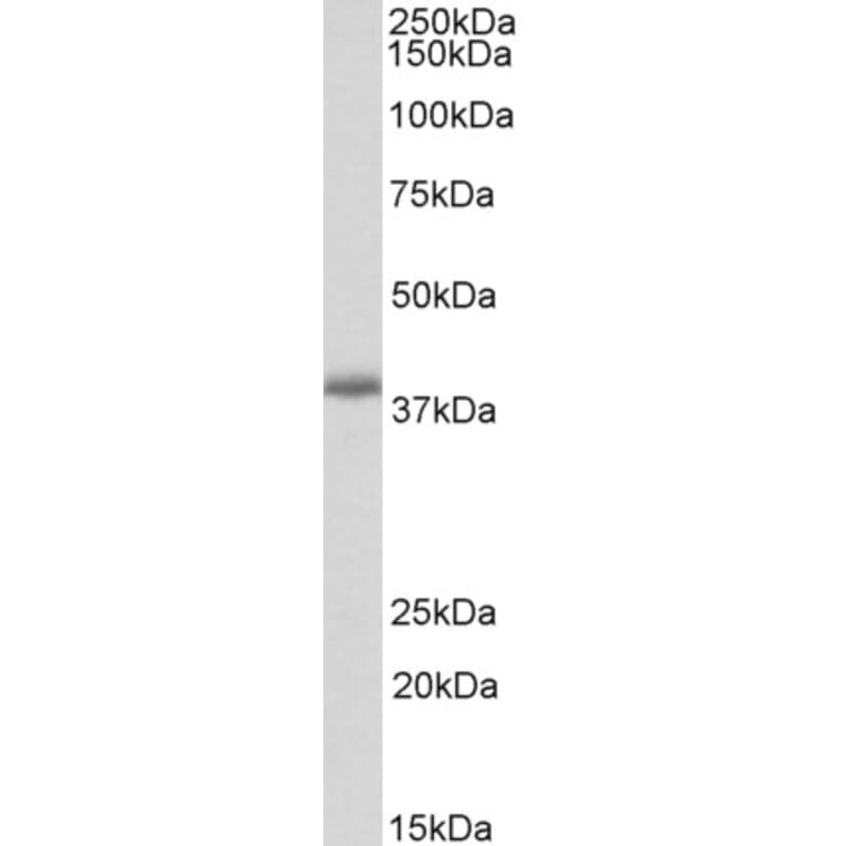 Western Blot - Anti-PDLIM2 Antibody (A82552) - Antibodies.com
