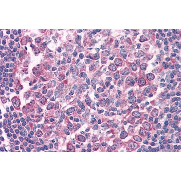 Immunohistochemistry - Anti-Fas Antibody (A82554) - Antibodies.com