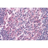 Immunohistochemistry - Anti-Fas Antibody (A82554) - Antibodies.com